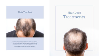 Hair Loss Treatments Business plan PPT Templates_10