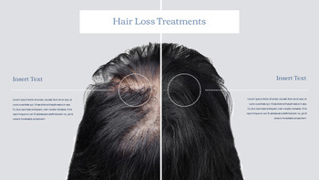 Hair Loss Treatments Business plan PPT Templates_18