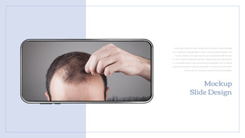 Hair Loss Treatments Business plan PPT Templates_39