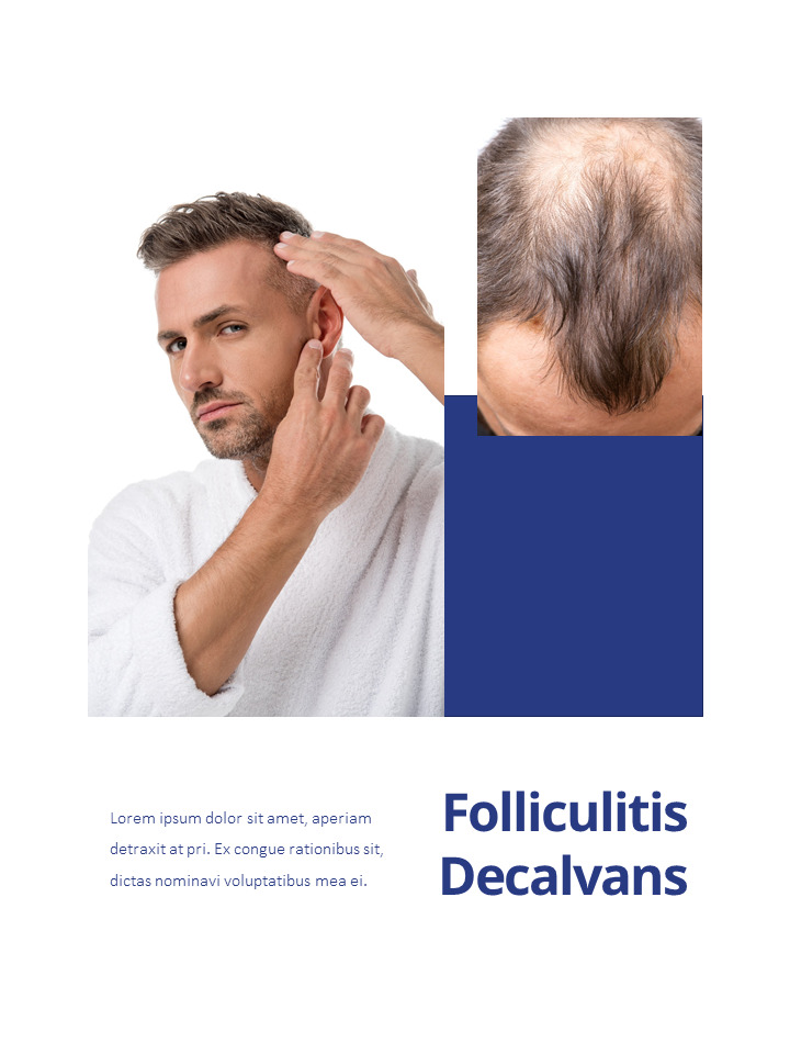Hair Loss Control Clinic Slide Ppt Hair Loss Control Clinic Slide Ppt